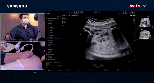 RevueVision's tweet photo. Échographie des reins au 2e trimestre - Live scan sur patientes https://t.co/PYJGL6LokI https://t.co/21ZjiMmbCx