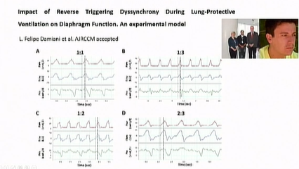 Gustavo Plotnikow 🇦🇷 (@gaplotnikow) on Twitter photo Reverse triggering: what is the meaning of this asynchrony?
Dr. Laurent Brochard 🇨🇦🇫🇷 con una lluvia de citas argentinas🇦🇷 y chilenas🇨🇱! Crack
XVII Congreso Uruguayo de Medicina Intensiva @SecretariaSumi Reverse triggering: what is the meaning of this asynchrony?
Dr. Laurent Brochard 🇨🇦🇫🇷 con una lluvia de citas argentinas🇦🇷 y chilenas🇨🇱! Crack
XVII Congreso Uruguayo de Medicina Intensiva @SecretariaSumi