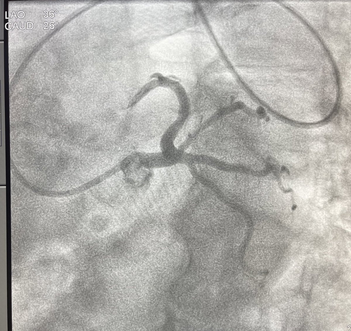 Rohan Kalathiya, MD tweet media