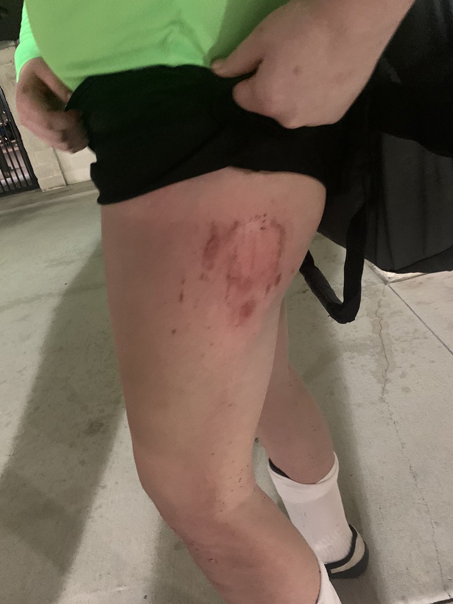 Little rough on the keeper tonight.
