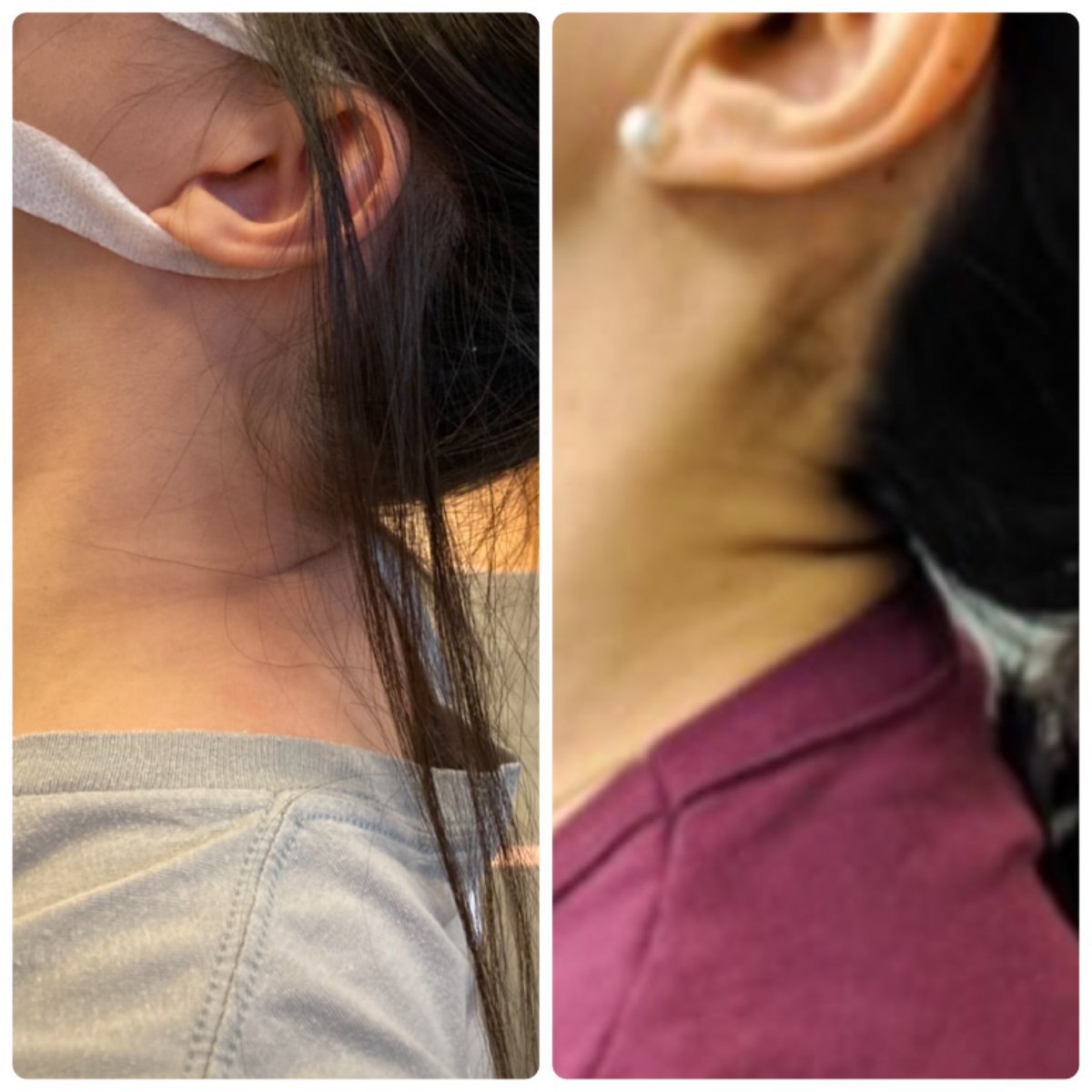 うなじケア Twitter Search Twitter