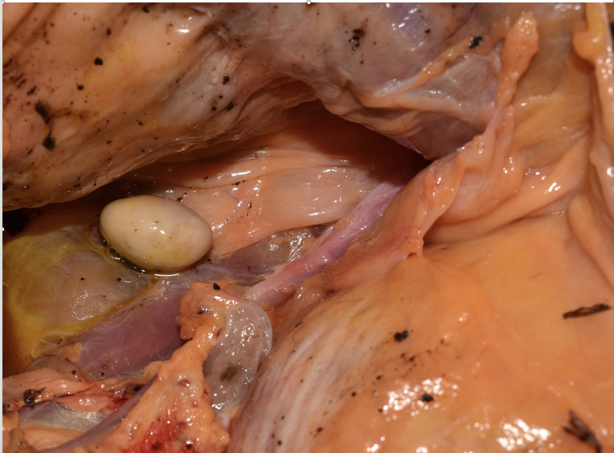 Willy Kemp tweet media