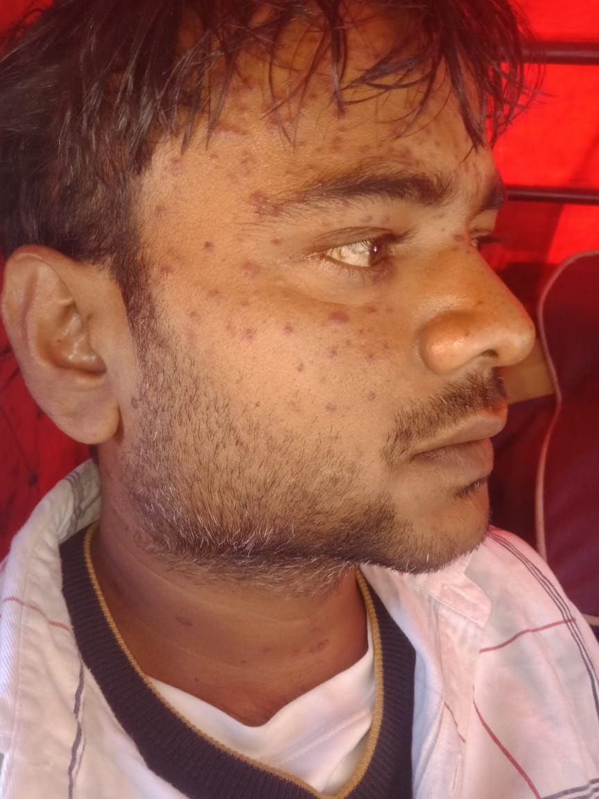Manijha7867's tweet photo. Name - lallu
Problem blood cancer
कई दिनों से हॉस्पिटल के चक्कर लाग रहे है लेकिन किसी भी हॉस्पिटल मे इनको एडमिट नहीं किया
आज AIIMS ले गए लेकिन वह भी इनको एडमिट नहीं किया गया
@SonuSood @arjunbhatigolf @KNPSS @SatyendarJain @mansukhmandviya https://t.co/Cz6S9qmrWz