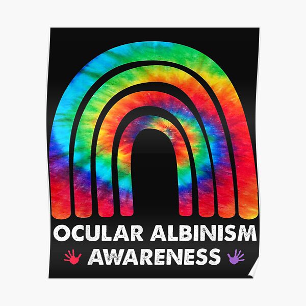 Heolddu_ALN's tweet image. Nystagmus and ocular albinism - sharing information to help raise awareness of visual impairment youtu.be/CjqHVTJfmG4 check out this video for a better understanding 👁 #visualimpairment #sencom #ocularalbinism #nystagmus