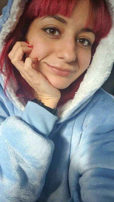 Had lip fillers for the first time two days ago. My lips are still a bit swollen but nothing too bad<a href="/tag/mvsales"class="tags"><span>#mvsales</span></a>