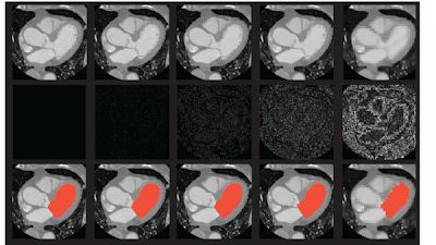 Radiology_AI's tweet photo. Octree Representation Improves Data Fidelity of Cardiac CT Images and Convolutional Neural Network Semantic Segmentation of Left Atrial and Ventricular Chambers https://t.co/8tGNNTBj1x @ContijochResLab @UCSDHealth @UCSDImaging #SemanticSegmentation #DeepLearning #HeartCT https://t.co/ScB19oizR6