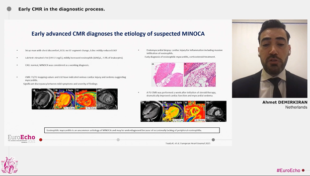 NabilNaser11's tweet photo. EuroEcho | Updates in MINOCA https://t.co/gddAFoCfVf https://t.co/LhycStGEZq