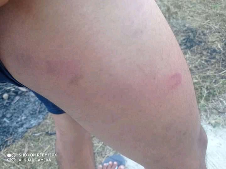 mcube_mcube's tweet photo. It is reported that 2 residents from Khayan tsp were beaten up by junta soldiers with the reason of riding in 2 people on a motorcycle yesterday.  #CrimesAgainstHumanity #Dec11Coup #WhatsHappeningInMyanmar https://t.co/p8nboGJD94