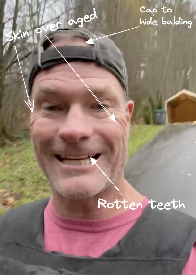 PeterMilesMD's tweet photo. This is Shawn Baker. The leader of the Carnivore diet, anti-vaxxer, who made a business selling supplements and diet programs (meat-only). I would say his own diet isn't work well for him. https://t.co/KUMYH7ziOG
