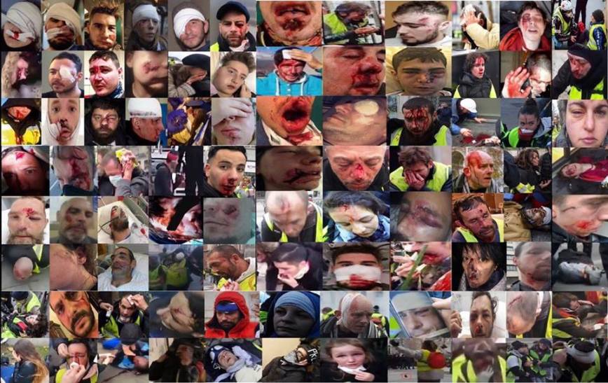 LaurentThines's tweet photo. Effectivement - félicitations 

On n’a jamais autant massacré d’opposants politiques en France depuis la 2ème Guerre Mondiale.

400 mutilés 30 éborgnés 5 mains arrachées et des 100aines de gueules cassées

#FoutageDeGueule #GueulesCassées #LBD #GLIF4 https://t.co/8yLkZkjYOc