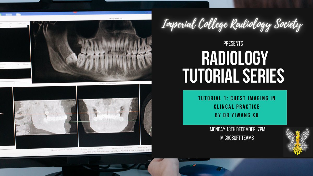 We have our 1st tutorial on chest imaging as part of our radiology series happening on Monday @ 7pm! We'd love to see you there: fb.me/e/2F1YfcTmg #radiology #education #MedEd #tutorial