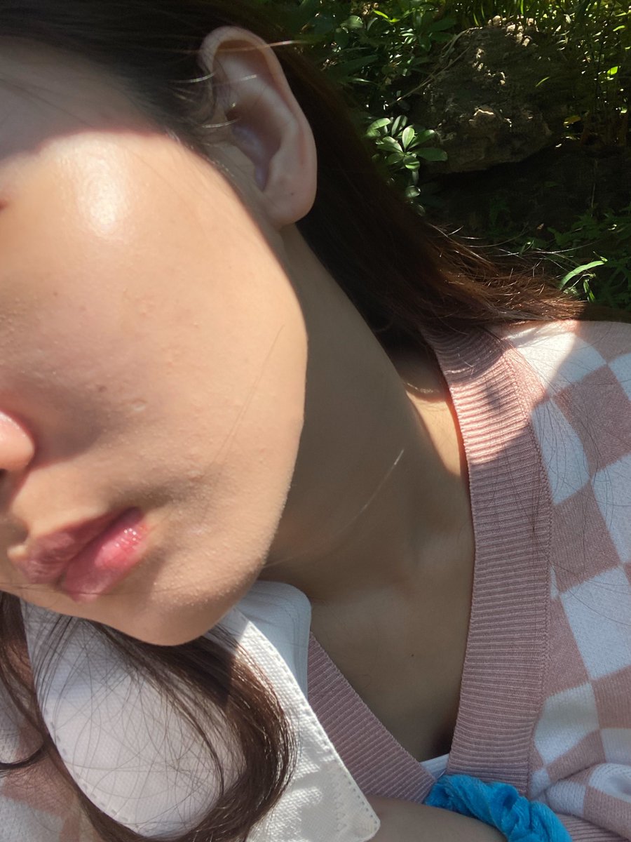 review_diary's tweet photo. หลงรักหน้าตัวเองมากตอนนี้ เราพึ่งรับปริญญาไปละแบบว่าทำไมตัวเองหน้าเนียน ขาวขึ้น รูขุมขนเล็กลง อิ่มน้ำ  คนทักเยอะมาก คือเราไม่ได้ใช้ไรเลยนอกจากมาส์กมะลิตัวเดียวทุกคืนคือเอาอยู่จริง เค้าไม่ใส่น้ำหอมและพาราเบนด้วย 🥺💖 
#มาส์กมะลิ   #maliijellymask #มะลิเจลลี่มาส์ก  @maliithaialnd https://t.co/gmKQhStPCh