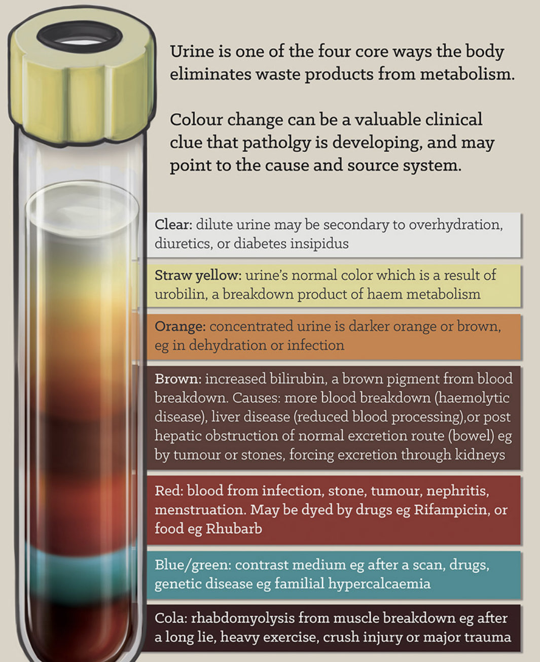 Моча коричневая что это значит. Моча коричневая что это значит. Моча коричневая что это значит. Тёмно янтарный цвет мочи. Нормальный цвет мочи.
