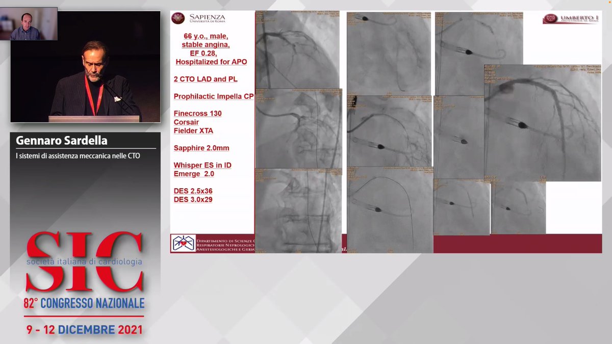 LAzzaliniMD's tweet image. #CTO session at the 82nd Italian Society of Cardiology meeting.
Thanks to Drs. Di Mario, Galassi and Sardella for the engaging discussion about the indications and current hot topics in CTO PCI.