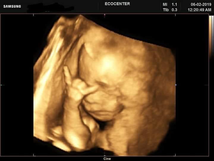 Dr dalam perut sudah metal duluan🤙🤙🤙