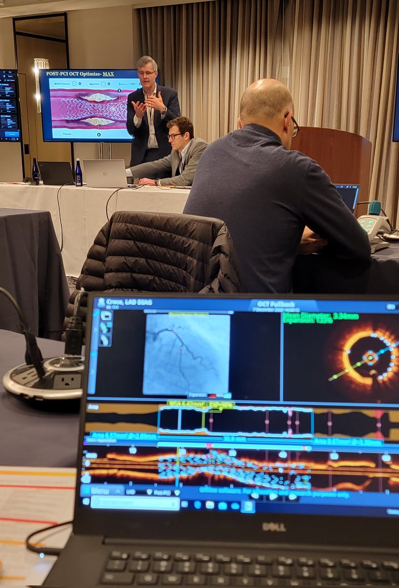 haseebqazi's tweet image. Excellent Hands on Workshop on OCT skills and image interpretation @AbbottCardio #PCIMASTERS @kevinjamescroce @ekgpdx @lindsey_cilia @MichaelMegalyMD