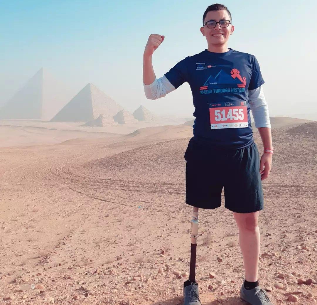 elkelany92's tweet photo. الحمد لله We are back again 💪🇪🇬
ماراثون الاهرامات 🇪🇬🏃♂️
العوده بعد غياب سنتين في ماراثون دولي من 4000 مشارك من 71 دولة مختلفة وانا المشارك الوحيد بالطرف الصناعي
الإرادة تصنع المستحيل 💪
#pyramidshalfmarathon https://t.co/6Pwlb0BaLd