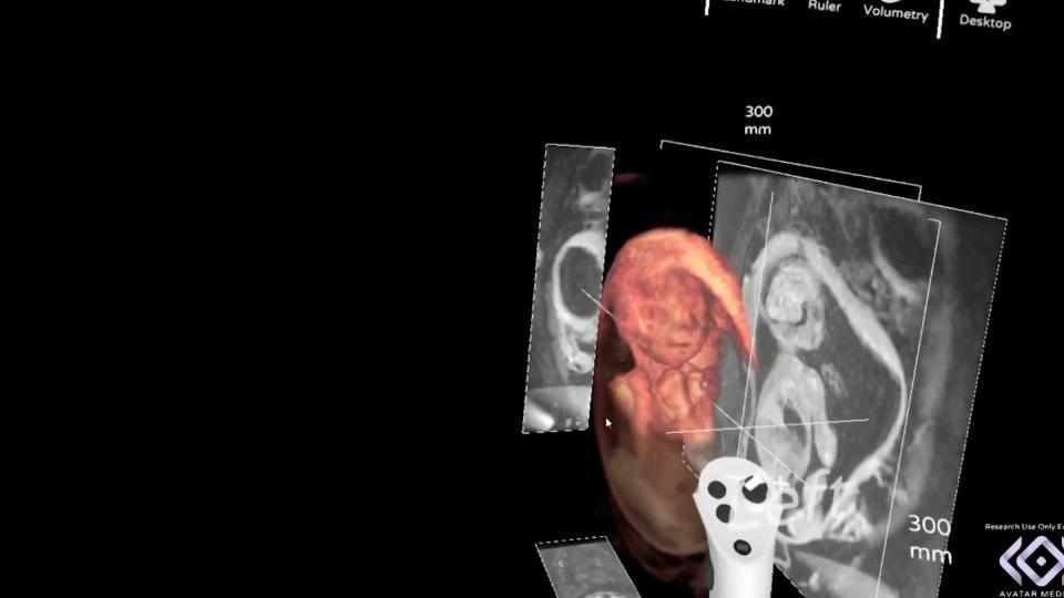 VIDÉO - Comment la plateforme LUMIÈRE de l’hôpital Necker révolutionne l'observation in utero du fœtus bit.ly/3yDg2G4