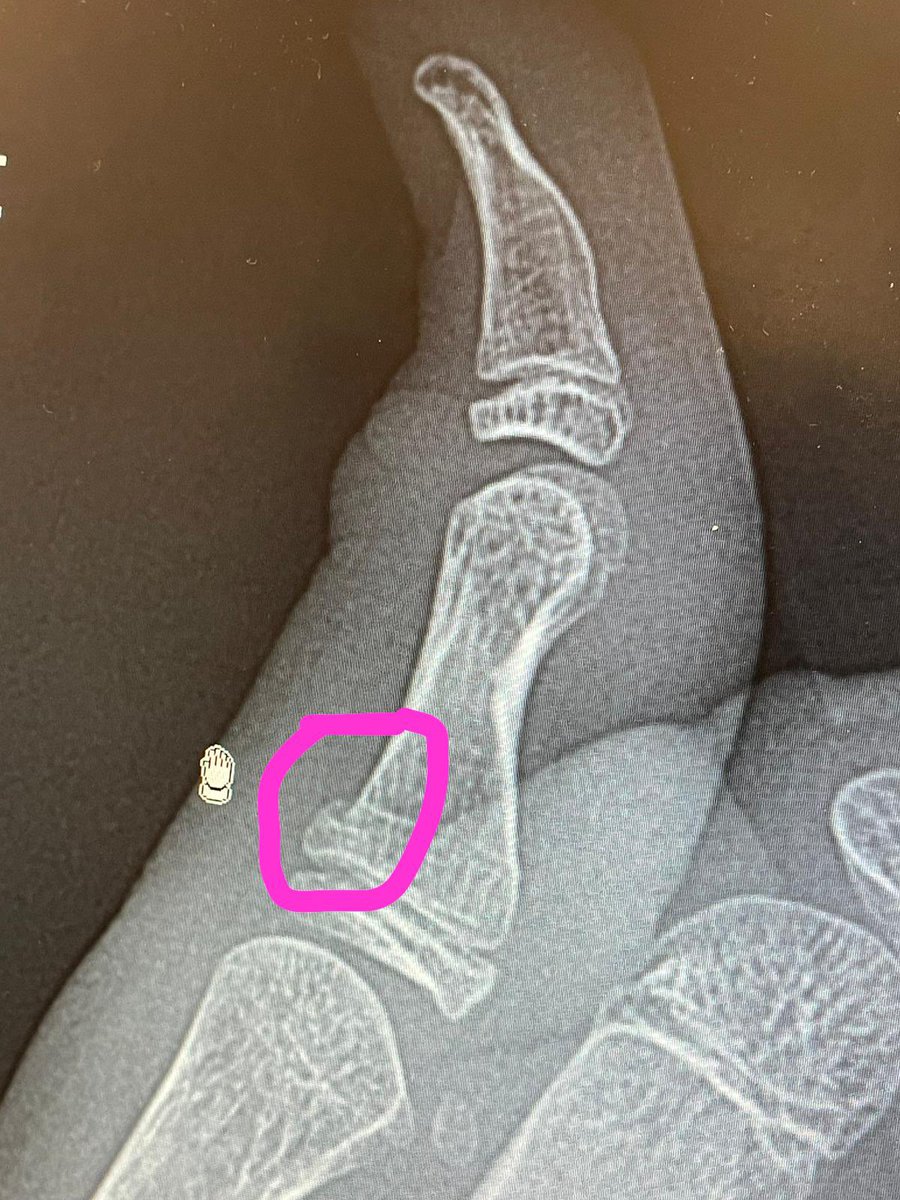 Susan Love tweet media