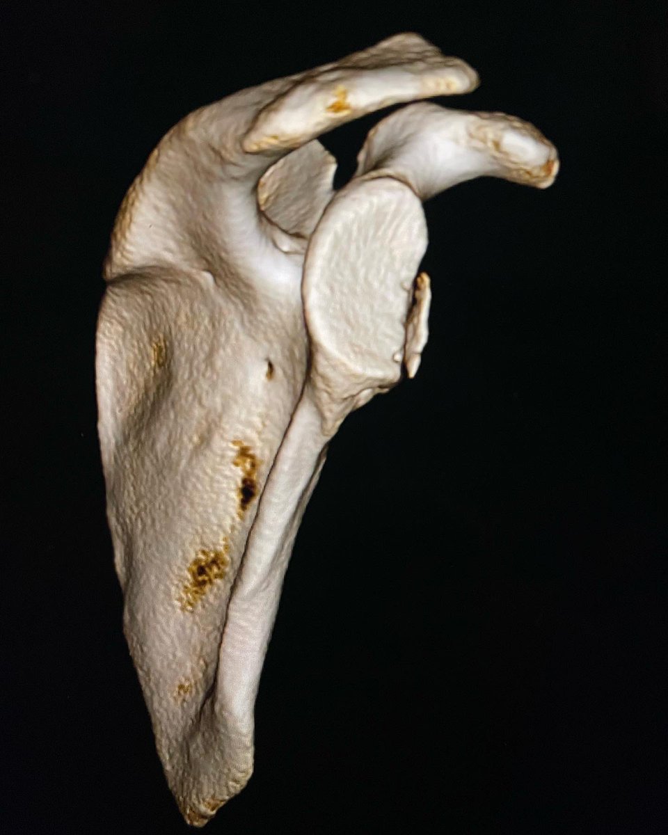 Carolyn Hettrich MD MPH FAOA tweet media