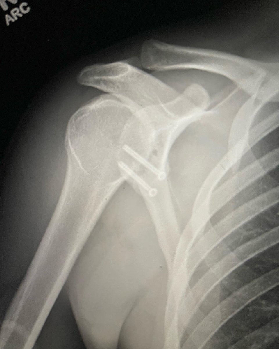 Carolyn Hettrich MD MPH FAOA tweet media