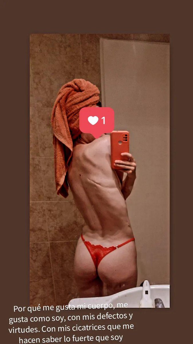 AnaRuax's tweet photo. Porque me gusta mi cuerpo, me gusta como soy, con mis defectos y virtudes.  Con mis cicatrices que me hacen saber lo fuerte que soy https://t.co/PykNwpRshR