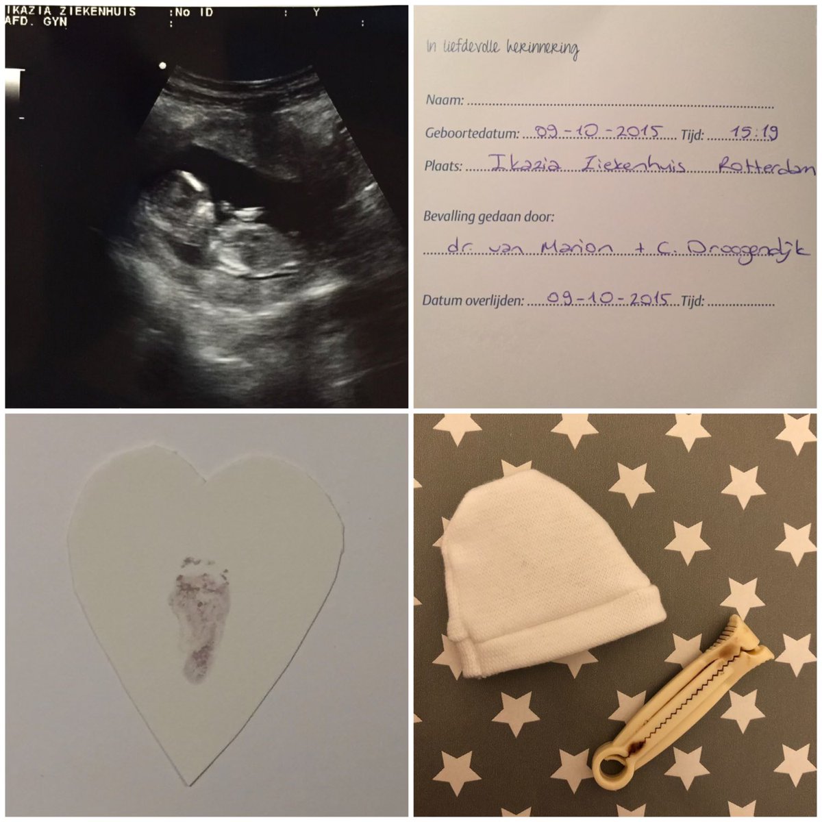 Tonight at 7 PM I’ll light a candle to remember my little baby boy - October 9, 2015 🕯Your wings were ready, but my heart was not…🤍

#WorldwideCandleLightingDay #wereldlichtjesdag #candlelightningday #stillbirth #infantloss #pregnancyloss