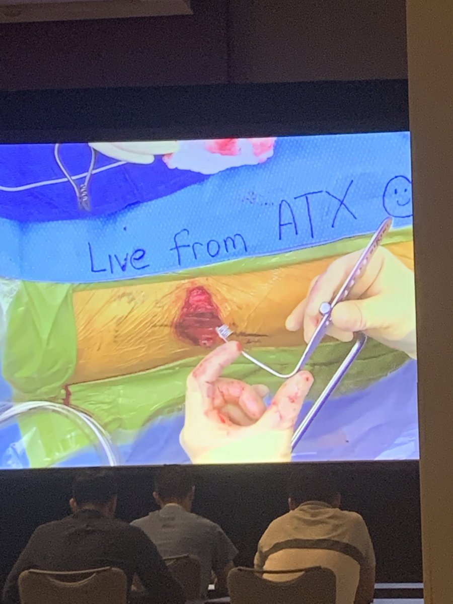#icjr THA anterior approach course, live surgery.