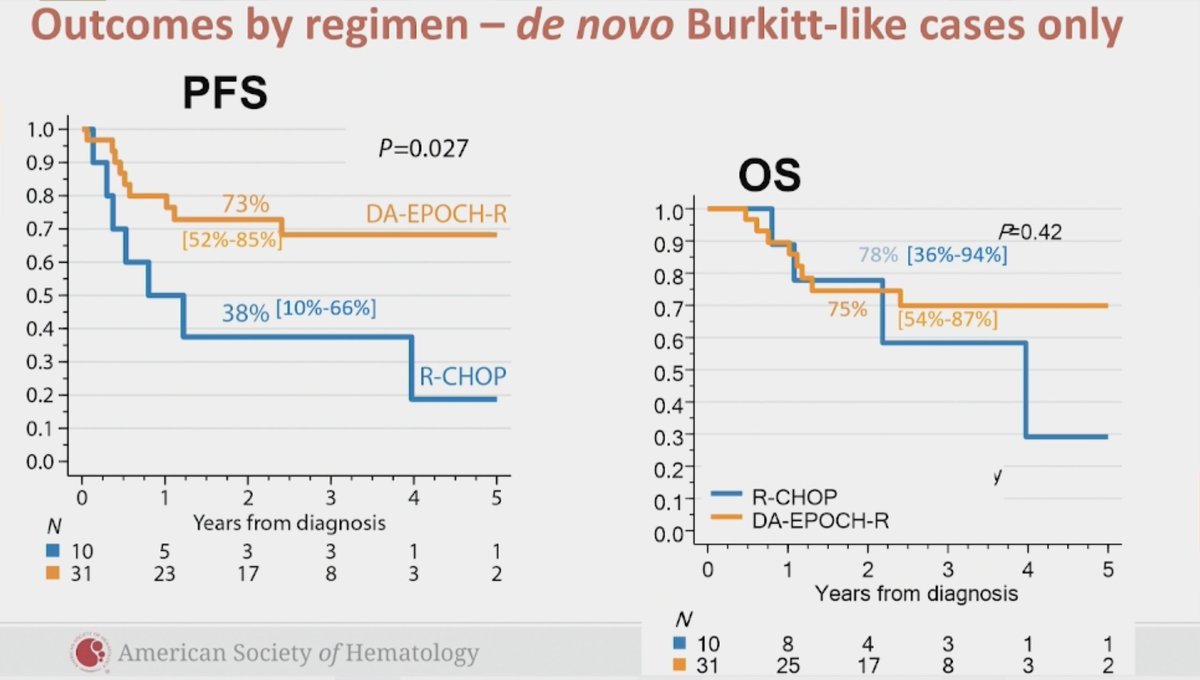 graham74GC's tweet photo. Zayac - HBGL-NOS characteristics &amp; outcomes
- 126, med age 64
- Age-adjusted IPI, stage, EN sites prognostic
- in whole cohort, no diff R-CHOP / DA-EPOCH-R
- de novo BL-like, DA-EPOCH assoc with ⬆️ PFS but not OS (also small group)
Rare and difficult group. 
#ASH21 #lymsm https://t.co/XZoUKw1l2n