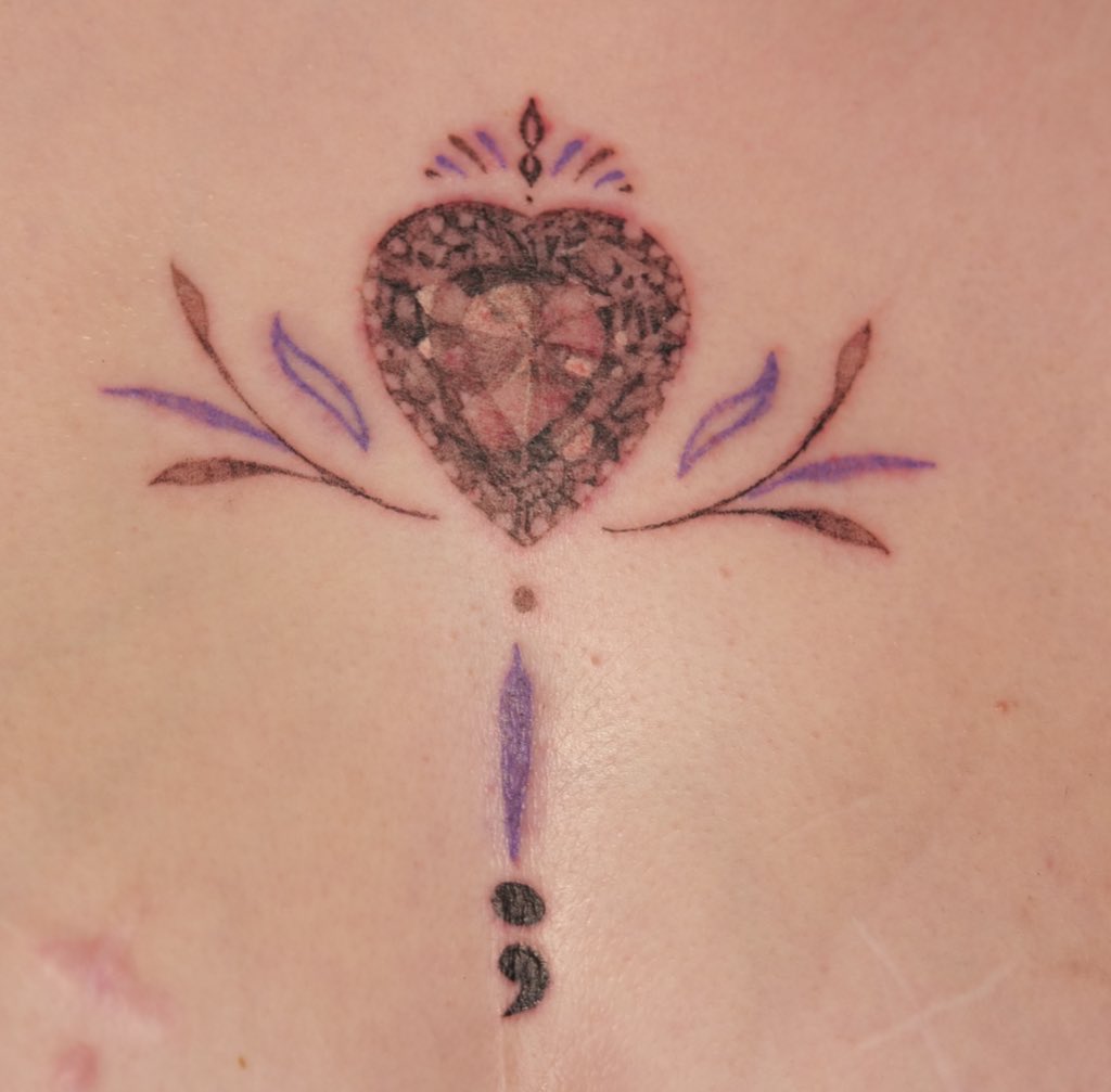 YareYareDawaaa's tweet photo. 2021 tattoo retrospective 🥰 (mes fav) tous par @jumotattoos !! https://t.co/qMcwkFj4SB