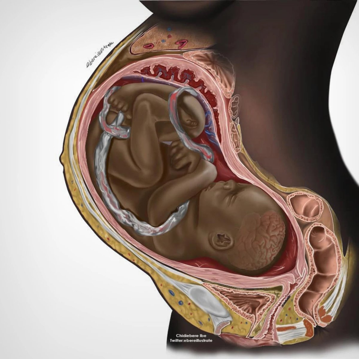 ReadingThePix's tweet photo. Stunning for breaching medical illustration color barrier &amp; that it would take so long. Love, also, how the cornrows pair w the heart. Now let’s get this young medical student from Lagos, Chidiebere Ibe (@Eberechs), some follows. https://t.co/qSAlfLEaHy