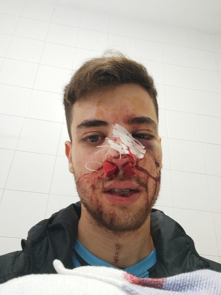 COMUNICAT OFICIAL del club davant l'agressió brutal soferta per un dels nostres jugadors en partit del Tercera Catalana d'ahir dissabte contra <a href="/charenysdemar/">C.H. Arenys de mar</a> . 

#FEMOKNET Tolerància ZERO amb la violència <a href="/FCPatinatge/">FCPatinatge</a>