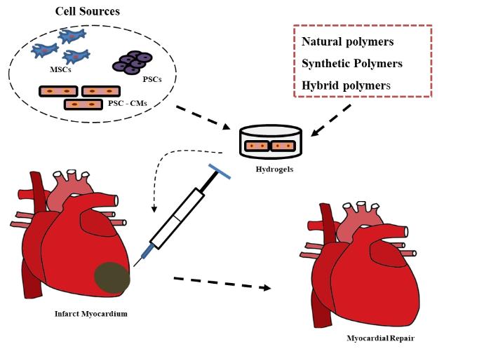 RCMjournal's tweet image. 🌟🌟🌟Top Cited paper (11/30)
Application of injectable #hydrogels for #cardiac #StemCellTherapy and #tissue engineering

#stemcell 

rcm.imrpress.com/EN/10.31083/j.…