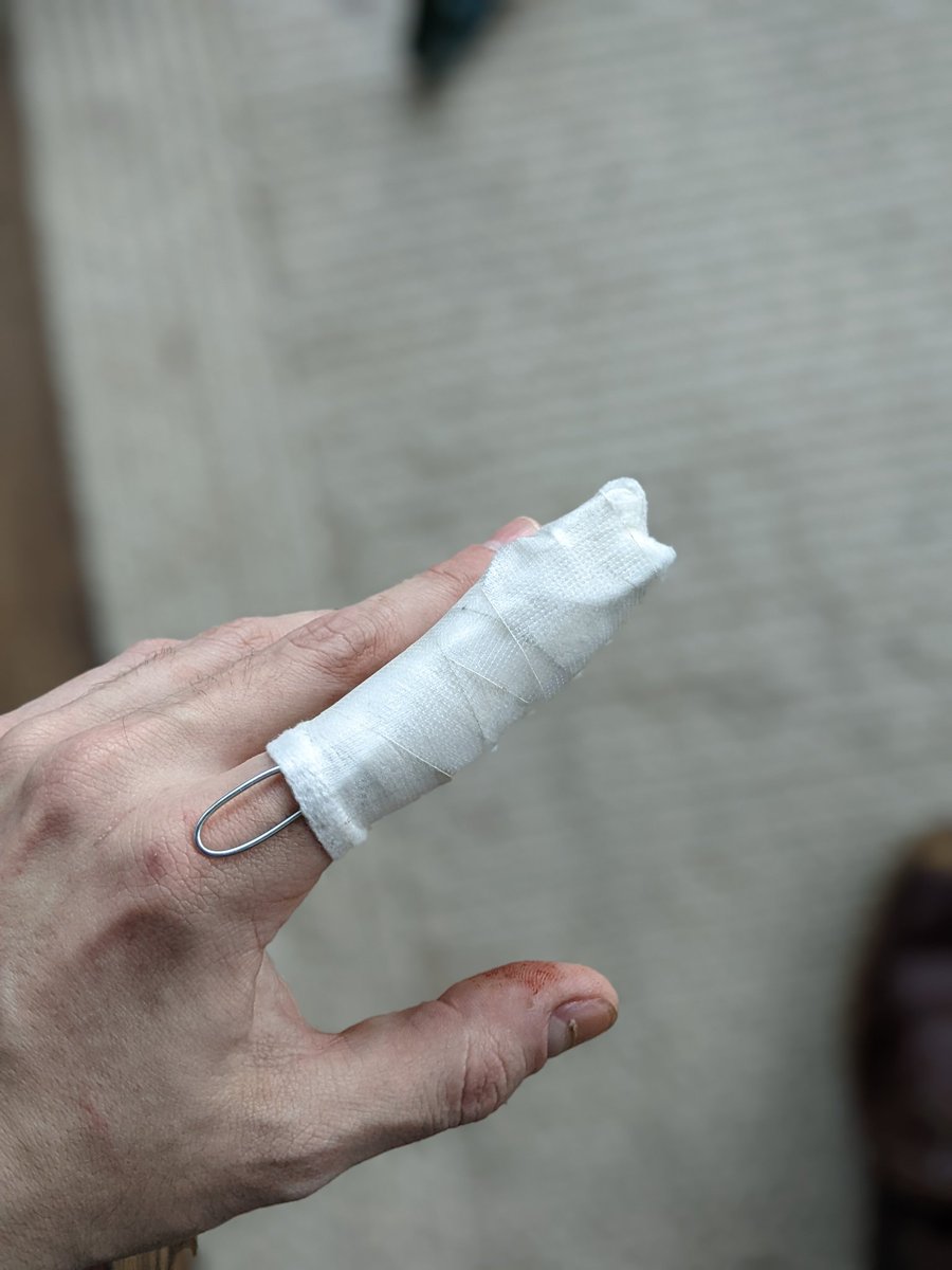 Desiowene's tweet photo. I lost a knife fight with a carrot today

ᴹʸ ᶠᶦⁿᵍᵉʳ ᶦˢ ˢᵘᵖᵖᵒˢᵉᵈ ᵗᵒ ᵇᵉ ᵈᵒʷⁿ ᶦⁿ ᵗʰᵉ ˢᵉᶜᵒⁿᵈ ᵖᶦᶜ🖕 https://t.co/TWYuEBzWg5