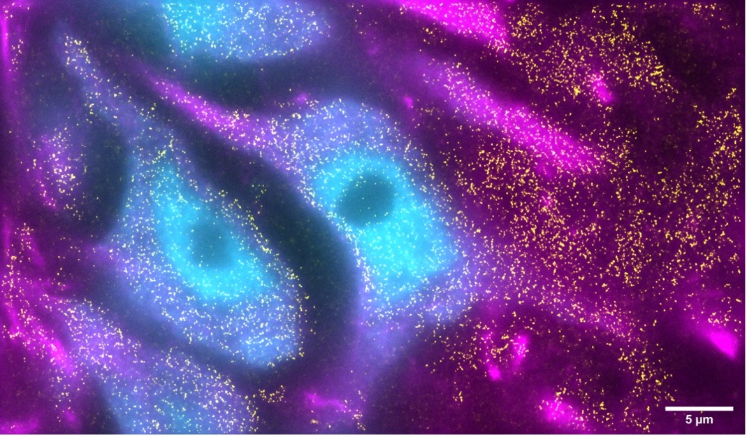 Last week we announced the winners of the Beautiful Minds mixed media neuroscience &amp; art competition, thank you to everyone who entered. We will share some of our favourites with you - starting with our winner 'Memories of a Starry Night' by Ruben Vergara Silva. #neuroscience