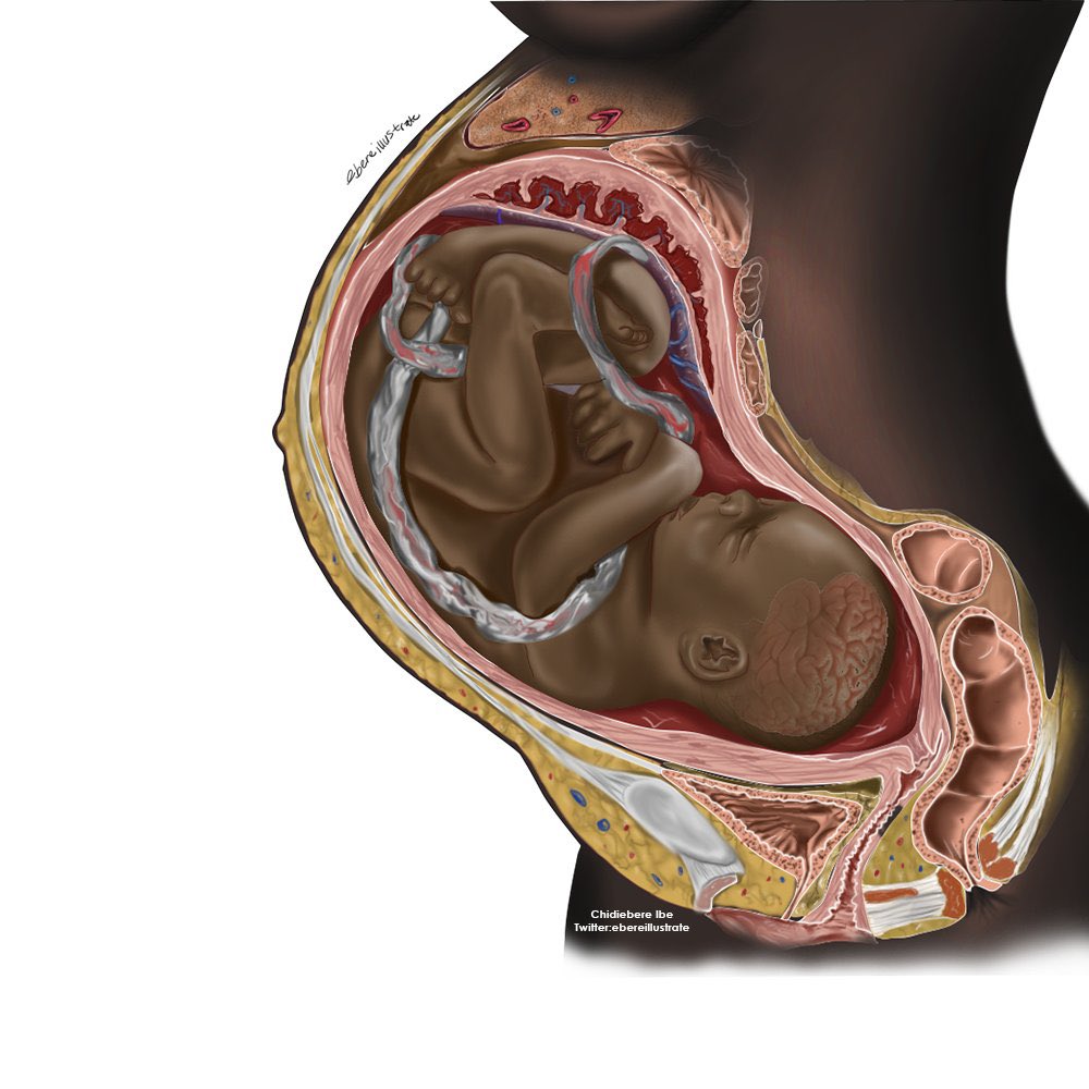 Beautiful illustration! I’ve never seen an anatomy illustration of a pregnant black woman. @ebereillustrate #RepresentationMatters #EquityinHealthcare