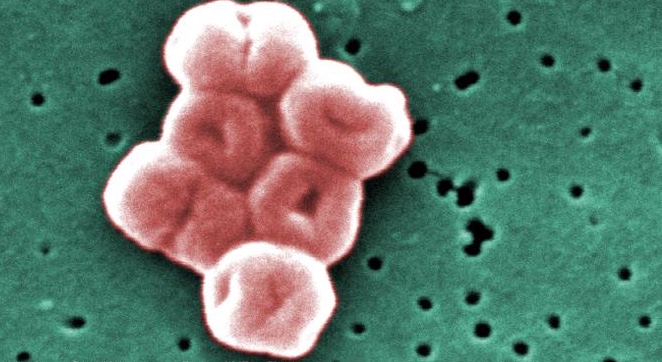 A_baumannii's tweet photo. Improved cleaning methods are needed to fight off Acinetobacter baumannii. This deadly pathogen can lurk on blankets, bed rails, door handles, light switches, bedside tables, curtains, and sinks in hospital rooms. https://t.co/pOTiG7vp9I……………… https://t.co/ycfljDHfXS https://t.co/CDIvKPNfoD