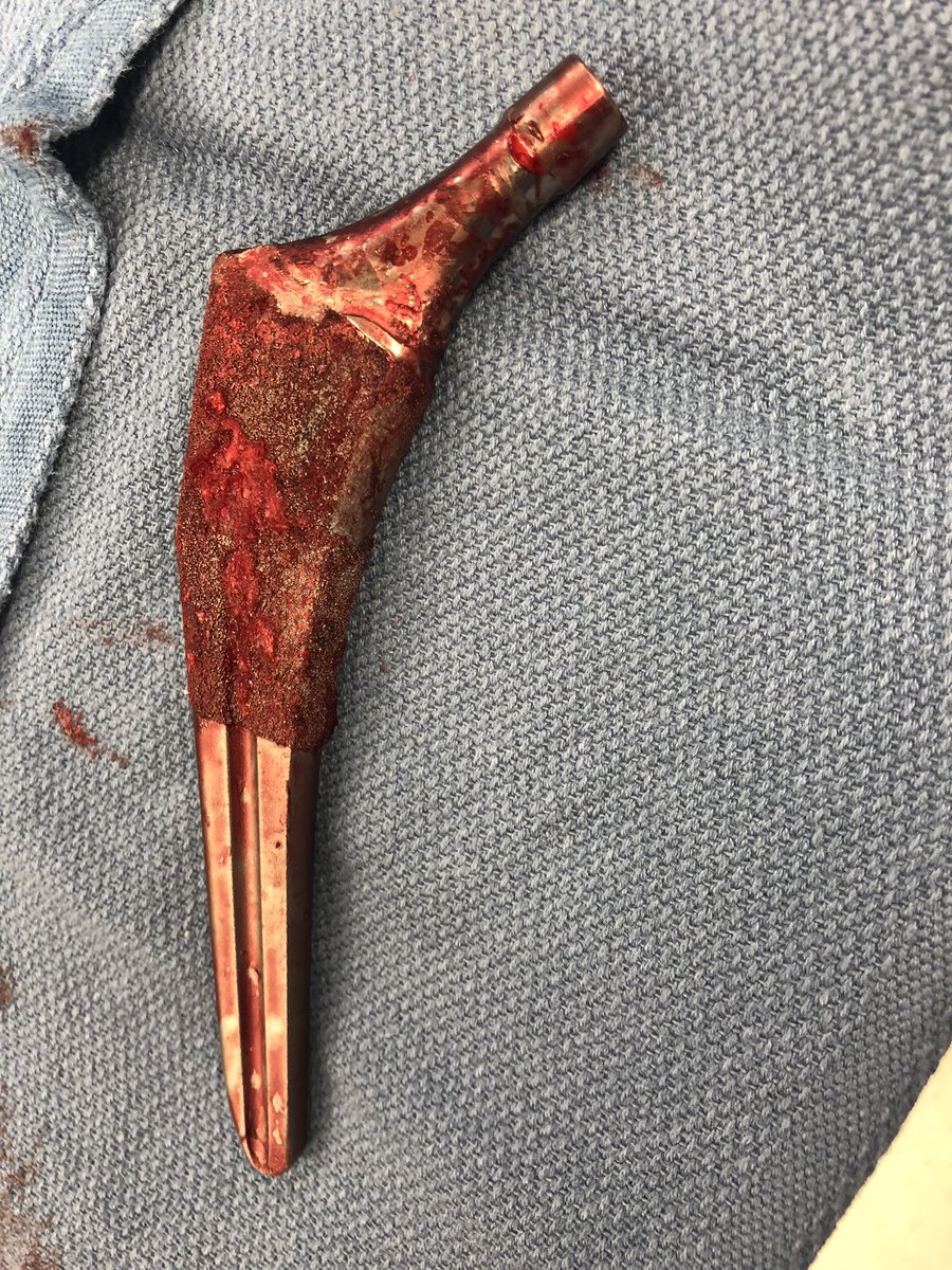 10 minutes and NO ETO!!  #orthotwitter