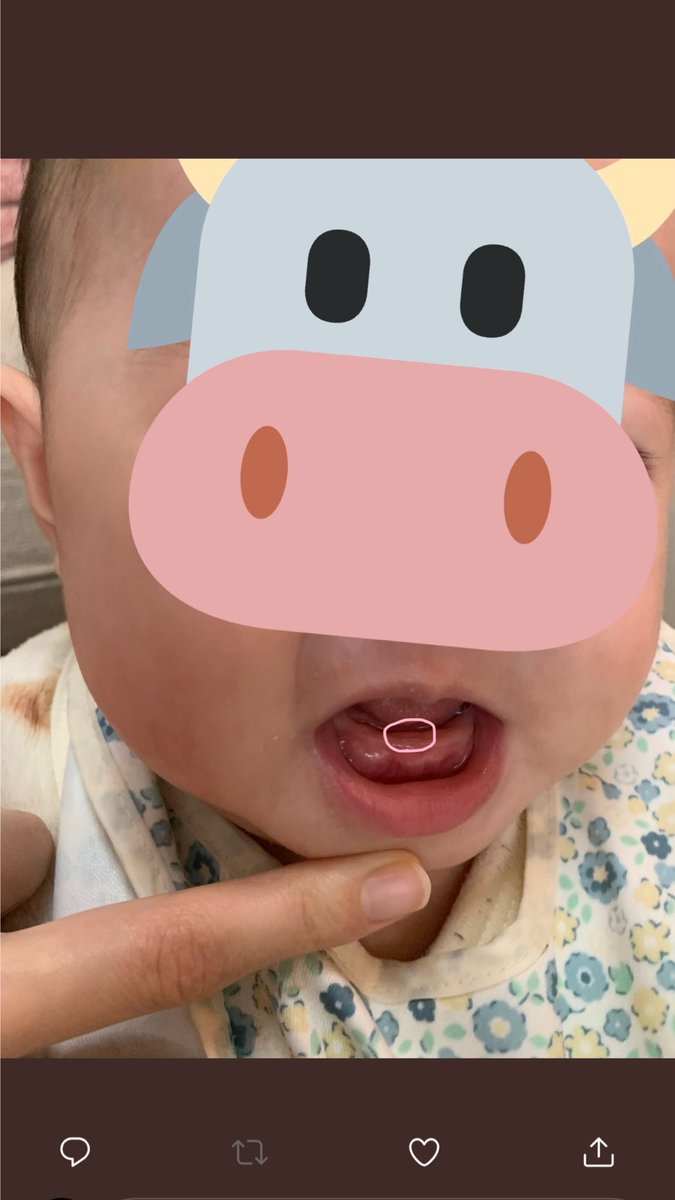 N_29_s's tweet photo. @mimi62096531 生えてるよ〜🤣💕
うち、もう2本ガッツリ生えてる🙄笑 https://t.co/xqNaVLoJL4