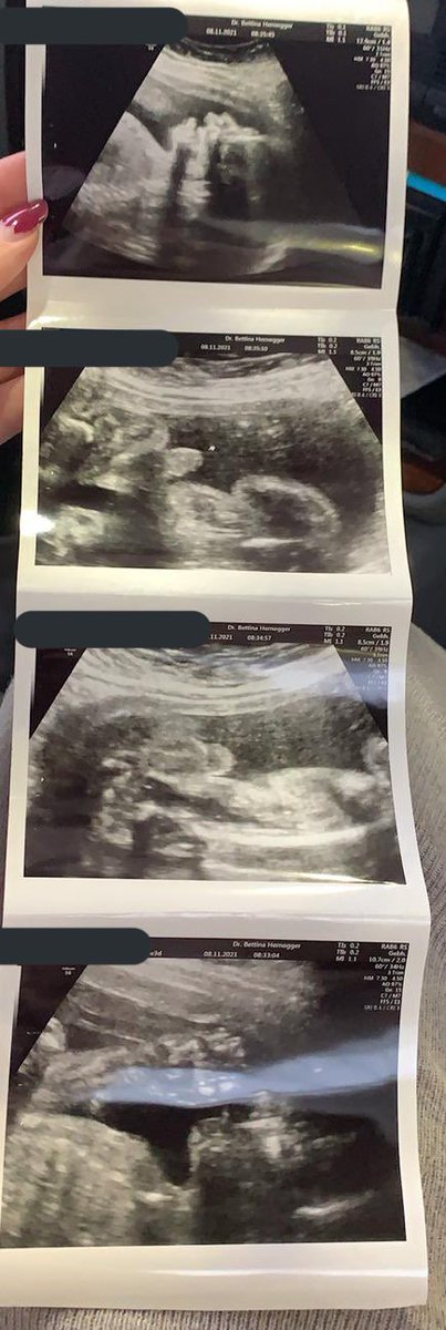 Preevez 🇦🇹 tweet media