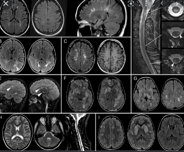 J_pediatric's tweet photo. Advanced #foetal brain magnetic resonance imaging is available for detection of #neurological conditions before the baby is born. This allows our team to plan your infant's birth so that efficient #treatment is instituted immediately after delivery. https://t.co/6BtJrHtNaD