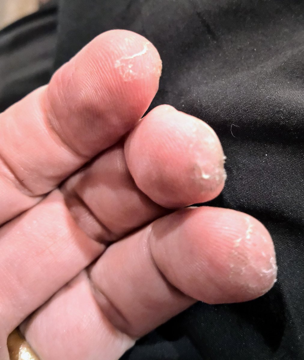 randomcodingdud's tweet image. #notcoding #notgamedev
Giving the fingers a good workout. Thanks to some old school Iron Maiden.
#thatsmetal #guitar #shredding