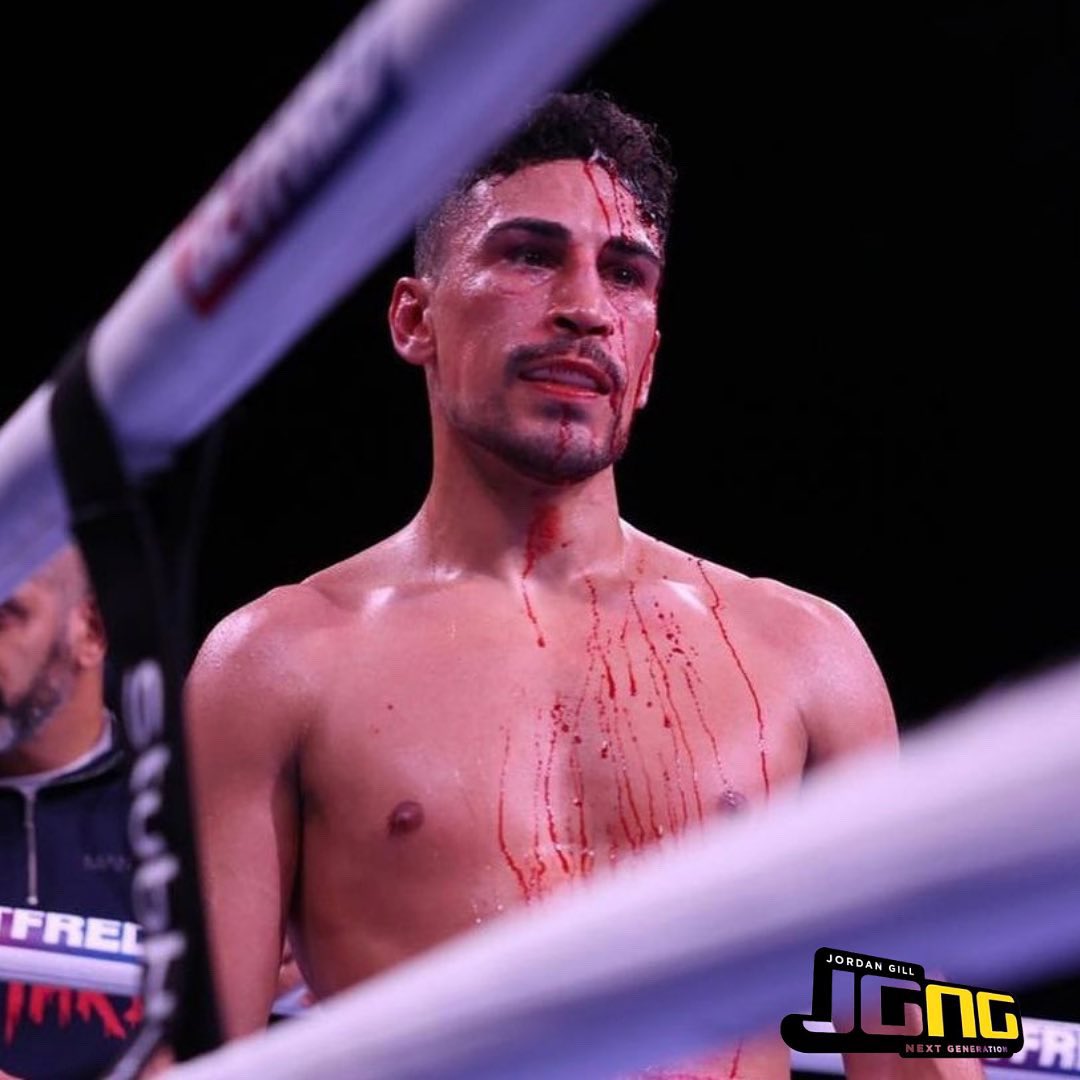 JGNXTGEN's tweet photo. Our man will be back stronger than ever, we look forward to competing for the European title! @_JordanGill
#unlucky #boxing #badcut #roadtorecovery #matchroom #matchroomboxing #boxer #letsgo #letsgojordan https://t.co/ClXBKaFR4U