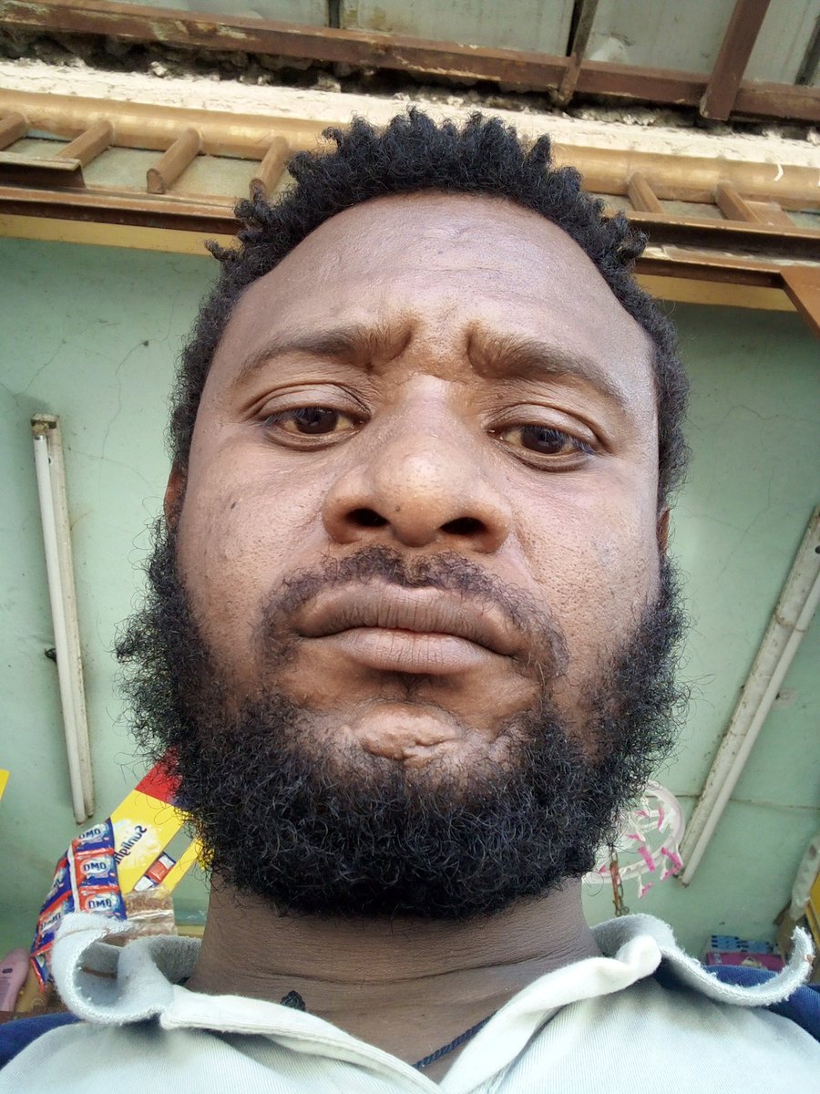 Getnet30's tweet image. 