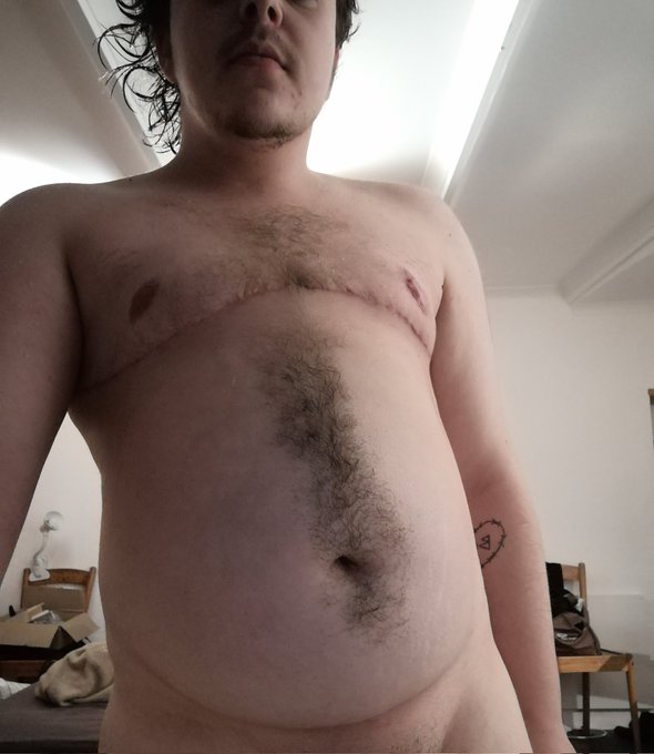 RT to see the full pic... https://t.co/ijFDVdfdOw<a href="/tag/transisbeautiful"class="tags"><span>#transisbeautiful</span></a><a href="/tag/transporn"class="tags"><span>#transporn</span></a><a href="/tag/ftmporn"class="tags"><span>#ftmporn</span></a>