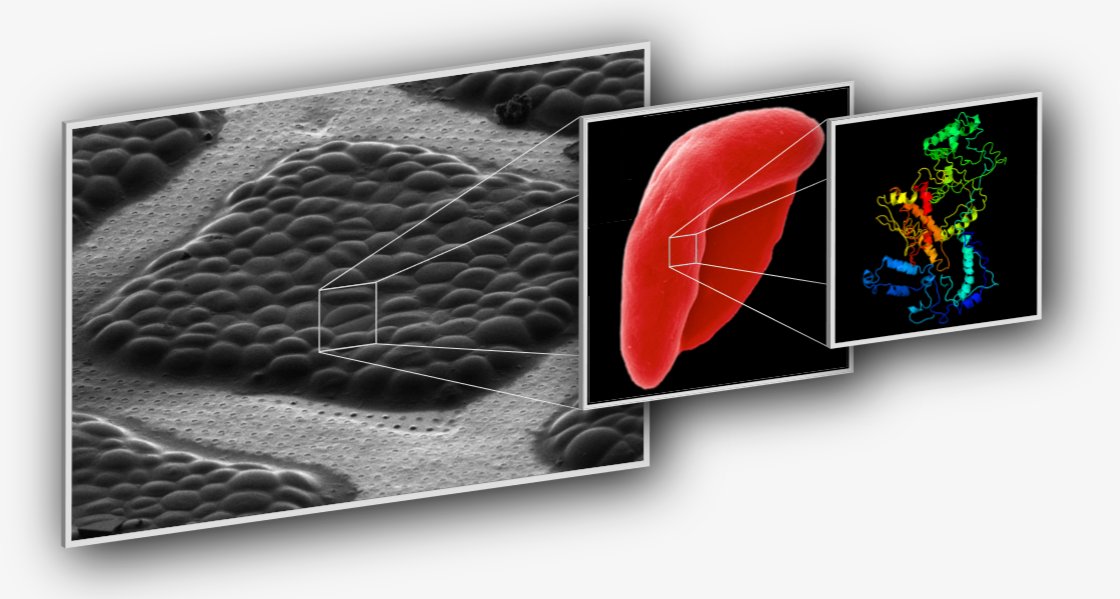 Job opening for a PostDoc!

Our lab has a 2-year position open for structural biologists interested in studying membrane protein complexes in the malaria parasite Plasmodium falciparum.

Application is open until 16th Jan 2022.

More details in link below:
embl.org/jobs/position/…