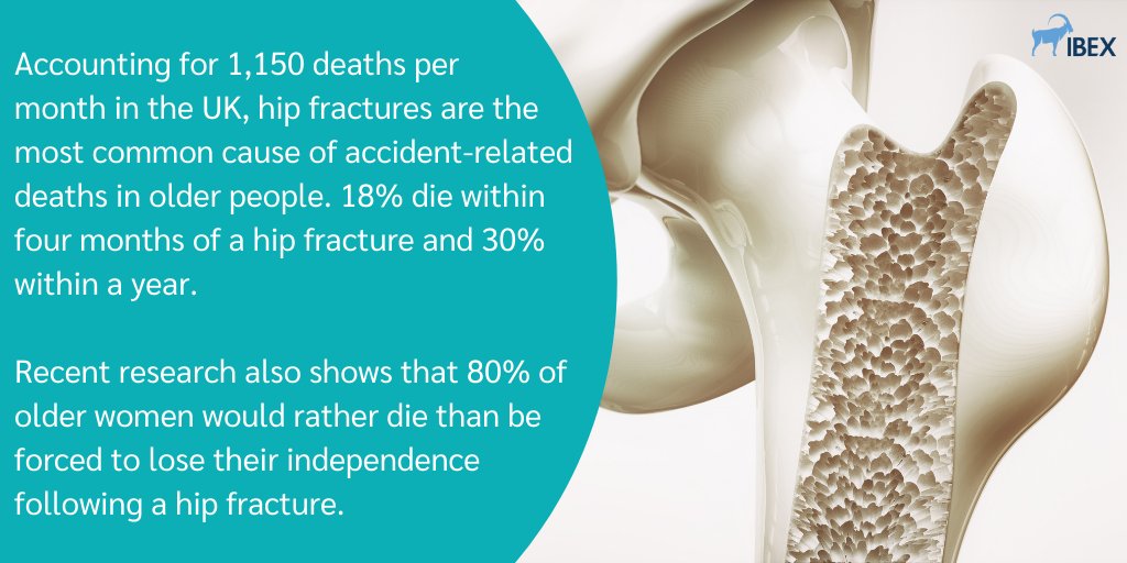 UK_IBEX's tweet image. Early warning signs of #osteoporosis often go unnoticed.

IBEX Trueview® software provides accurate #bonehealth diagnosis on standard DR scans, allowing us to screen 10-15 years before the onset of serious osteoporosis.

Learn more - lnkd.in/da-xvUr