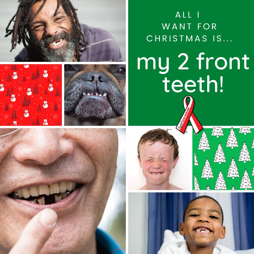 FightGumDisease's tweet image. All I want for Christmas is my two front teeth... the holiday song isn't just for kids - keeping your natural teeth can affect your total health. Motivation to keep brushing and flossing!  #MotivationMonday #2frontteeth #alliwantforchristmas