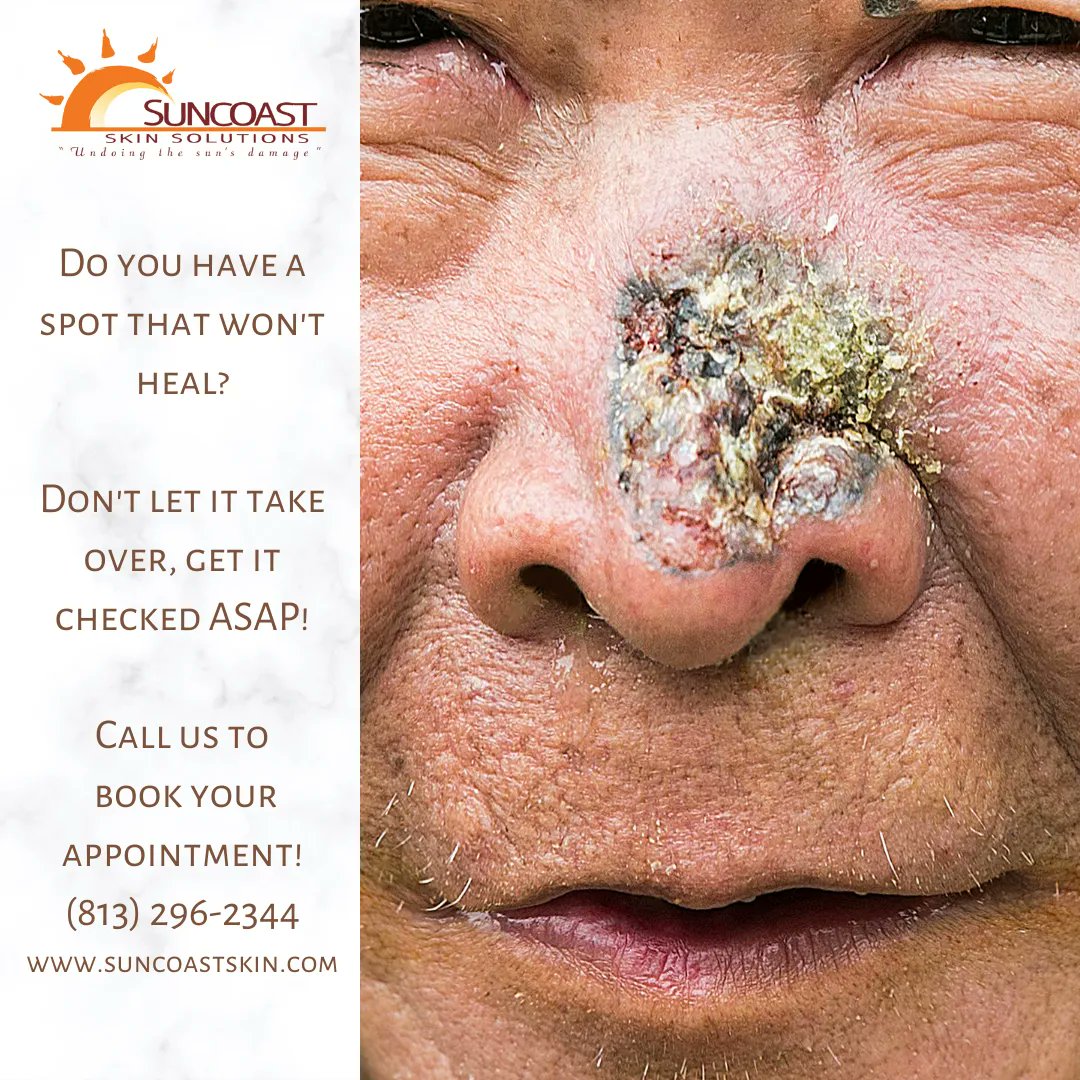 Suncoast Skin Solutions tweet media