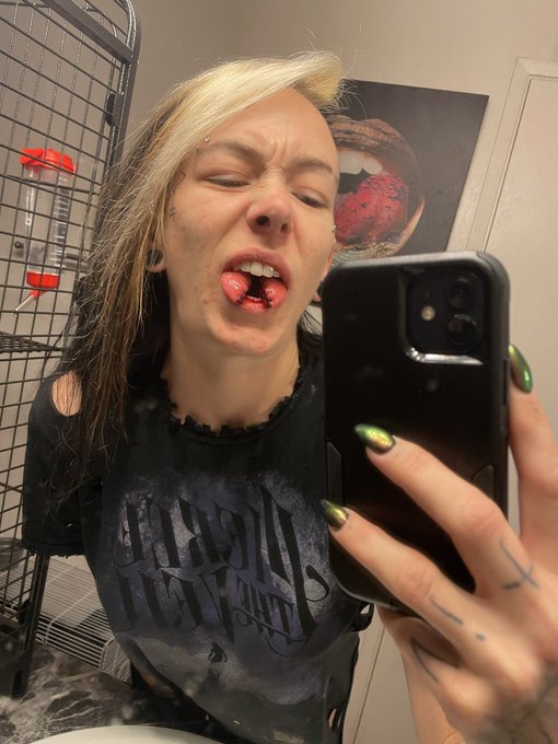 Split my tongue 10 days ago. First pic is minutes after finishing the split. Second pic is 2nd day and<a href="/tag/bodymodification"class="tags"><span>#bodymodification</span></a>